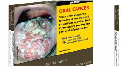 遏制吸烟：11月起加拿大将推出“最丑”香烟盒